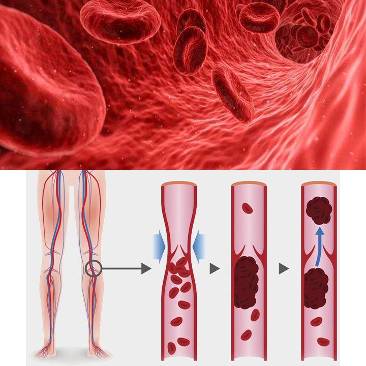Αποτοξινωτικά Φακελάκια Με Τζίντζερ Για Ποδόλουτρο (20 Τεμάχια)