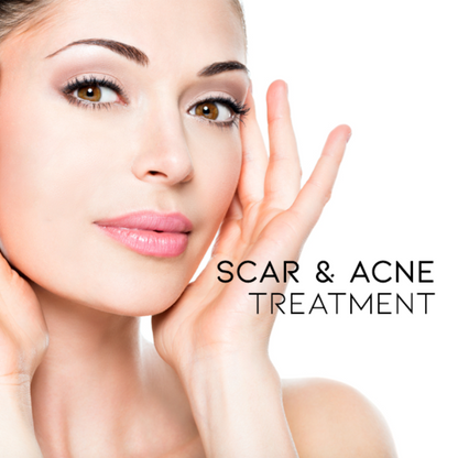 2 Κρέμες Αφαίρεσης Σημαδιών, Ουλών & Εξογκωμάτων Από Ακμή