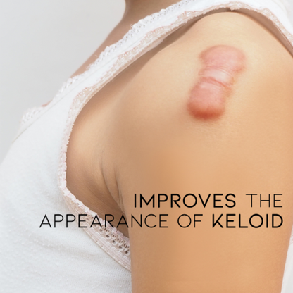 2 Κρέμες Αφαίρεσης Σημαδιών, Ουλών & Εξογκωμάτων Από Ακμή