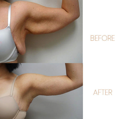 2 Φυτικά Λαδάκια Για Αποτοξίνωση & Καθαρισμό Του Λεμφικού Συστήματος