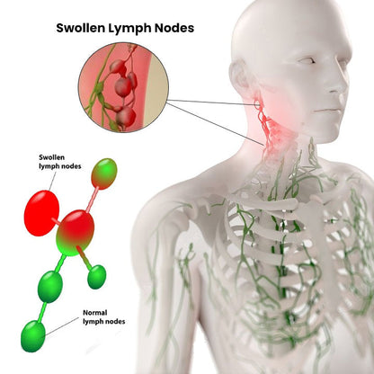 2 Φυτικά Λαδάκια Για Αποτοξίνωση & Καθαρισμό Του Λεμφικού Συστήματος